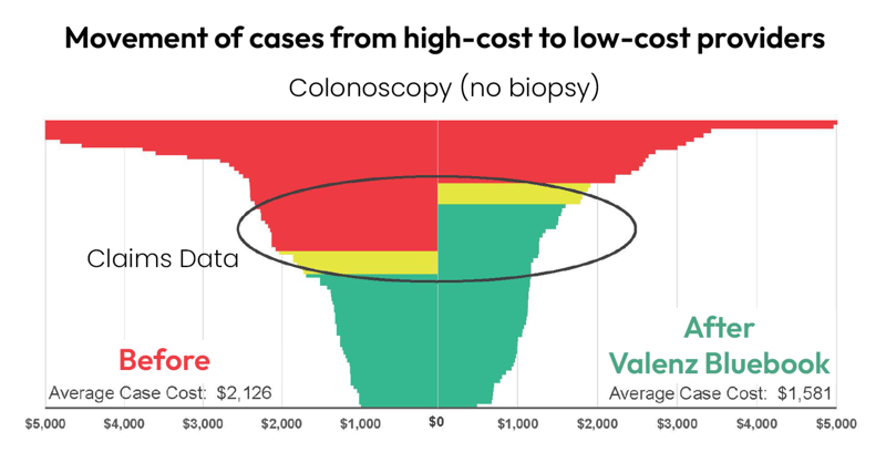 chart-movement-of-cases-from-high-cost-to-low-cost